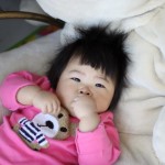 雪莱嘴角湿疹不知不觉不见了